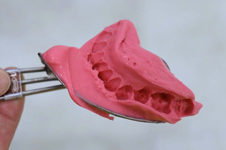 歯型をとるときに主流なピンク色の印象材「アルジネート」【写真：Hint-Pot編集部】