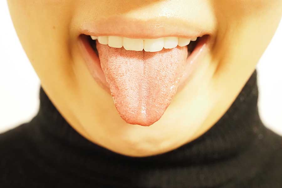 この機会に自分の舌をチェック（写真はイメージ）【写真：写真AC】