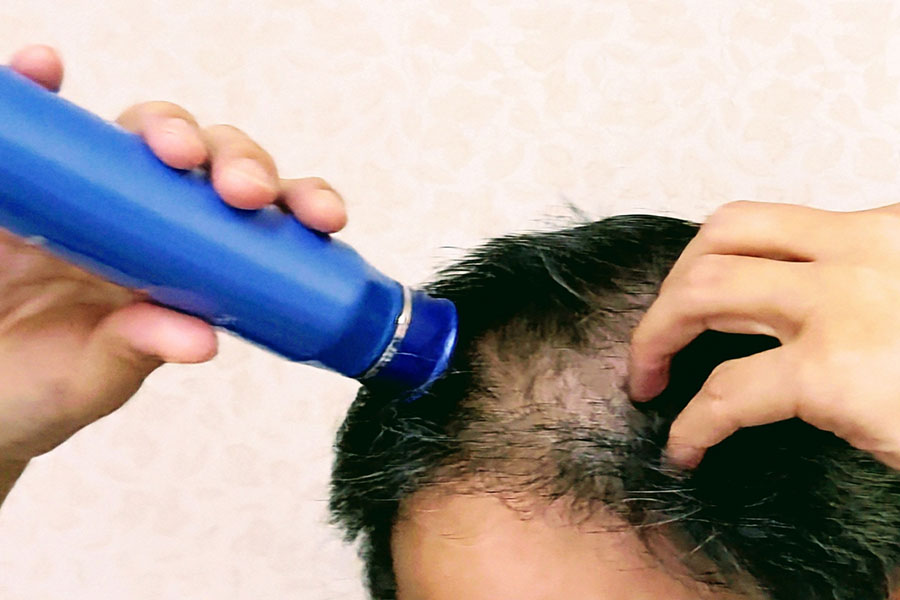 育毛剤が精子形成に悪影響を及ぼす可能性も（写真はイメージ）【写真：写真AC】