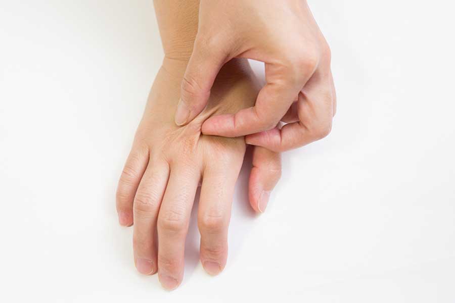 正常であれば、つまんだ跡は2秒で消える（写真はイメージ）【写真：PIXTA】