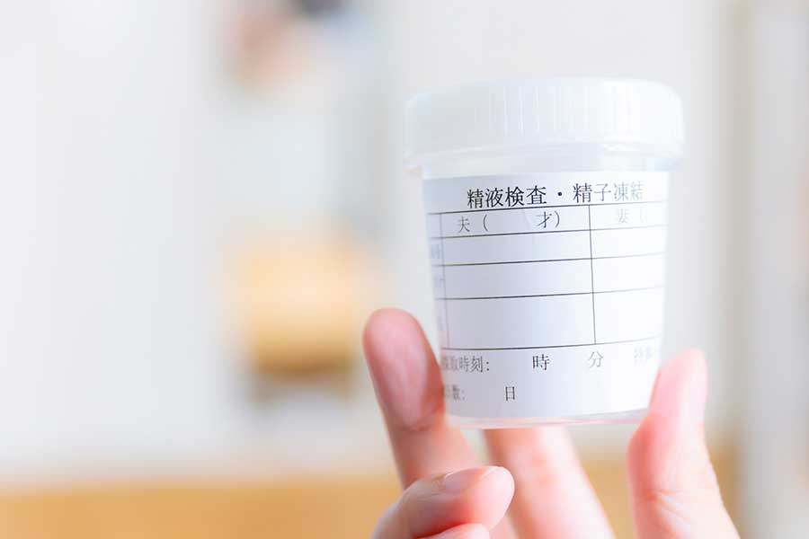 禁欲期間は2～3日を推奨する医療機関が多いよう。必要以上に長くしないように（写真はイメージ）【写真：PIXTA】