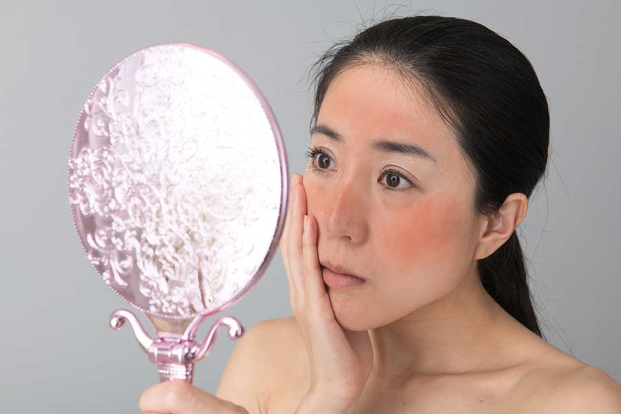 日焼け後の肌はどうケアすれば良い?(写真はイメージ)【写真:PIXTA】