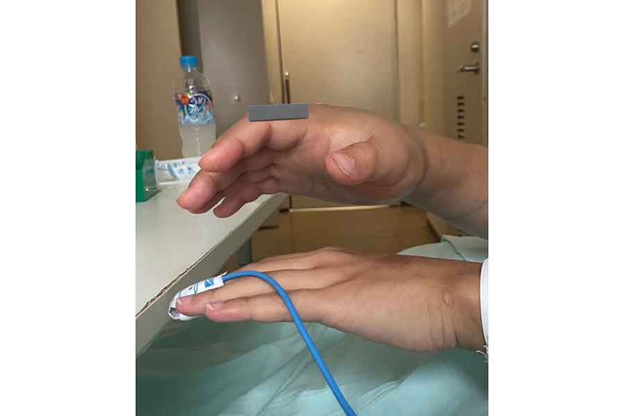 パンパンに腫れ上がってしまった友人の手【写真提供：ななしき（@7shikiwakko）さん】