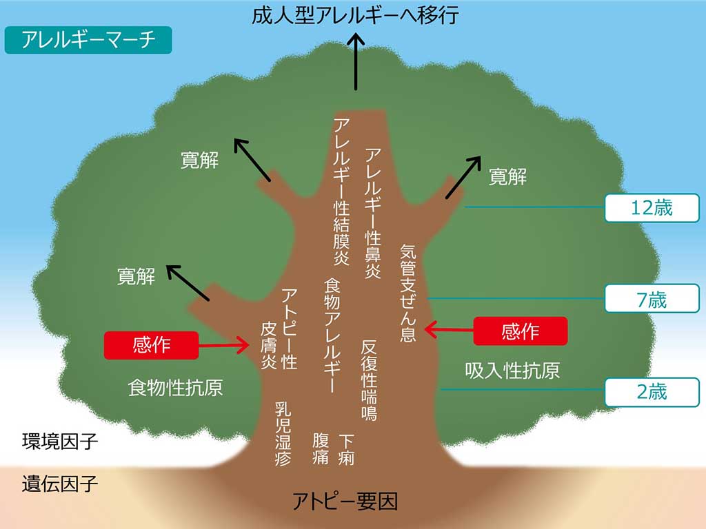 「アレルギーマーチ」のイメージ図