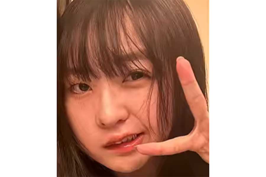 手術の後遺症で顔の左側に麻痺が【出典：YouTube「うーたん日記」よりスクリーンショット】