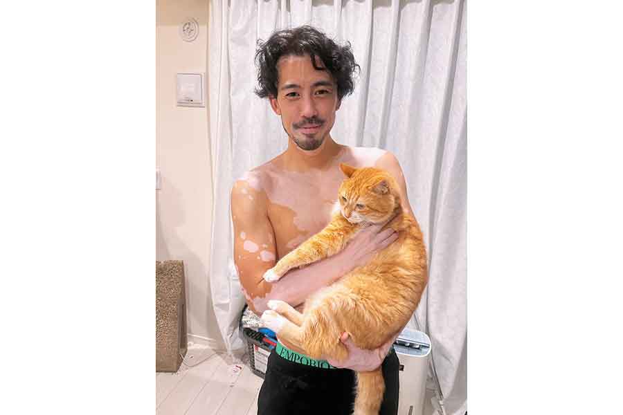 大好きな16歳の愛猫を抱くクニハルさん【写真提供：クニハルさん（vitiligo.9286）】