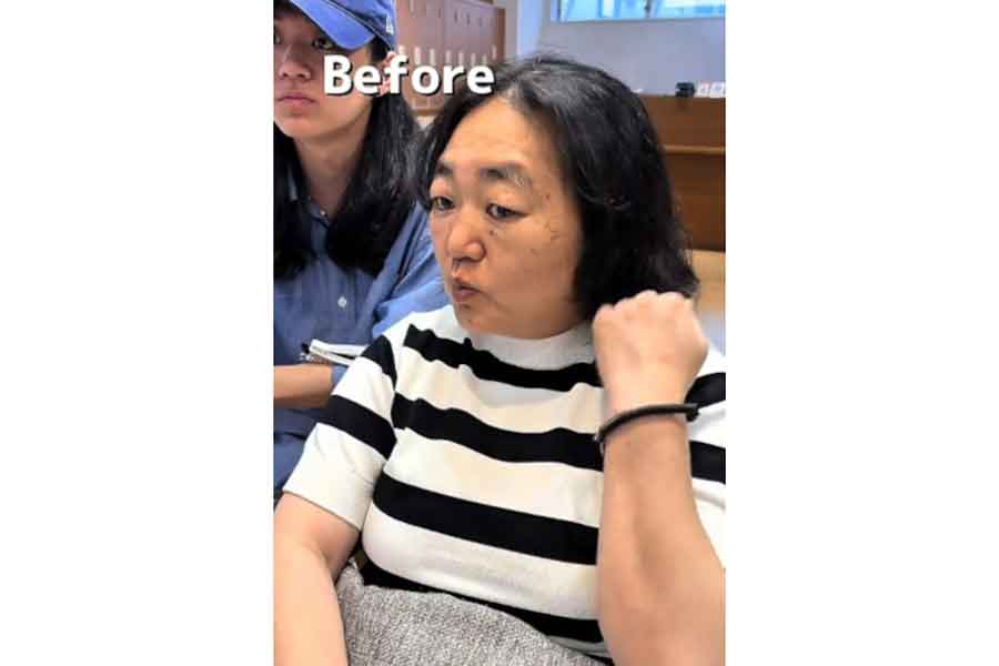 伸び切った前髪と全体のボリューム感に悩んでいた、施術前の女性【出典：TikTok（shoooota_3814）よりスクリーンショット】